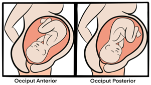 face presentation and c section